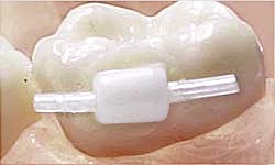 Bite Ramp Application